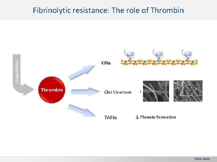Fibrinolytic resistance: The role of Thrombin Coagulation XIIIa Thrombin Clot Structure TAFIa ↓ Plasmin