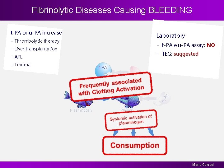 Fibrinolytic Diseases Causing BLEEDING t-PA or u-PA increase Laboratory − Thrombolytic therapy − t-PA