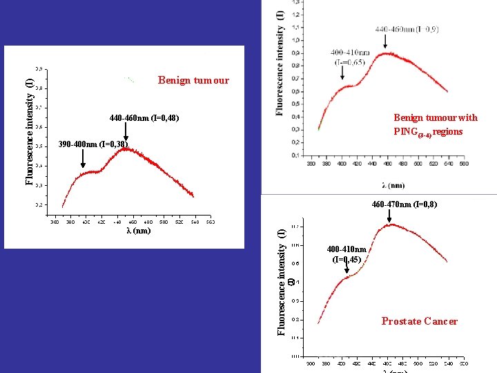 Benign tumour with PING(3 -4) regions 440 -460 nm (I=0, 48) 390 -400 nm