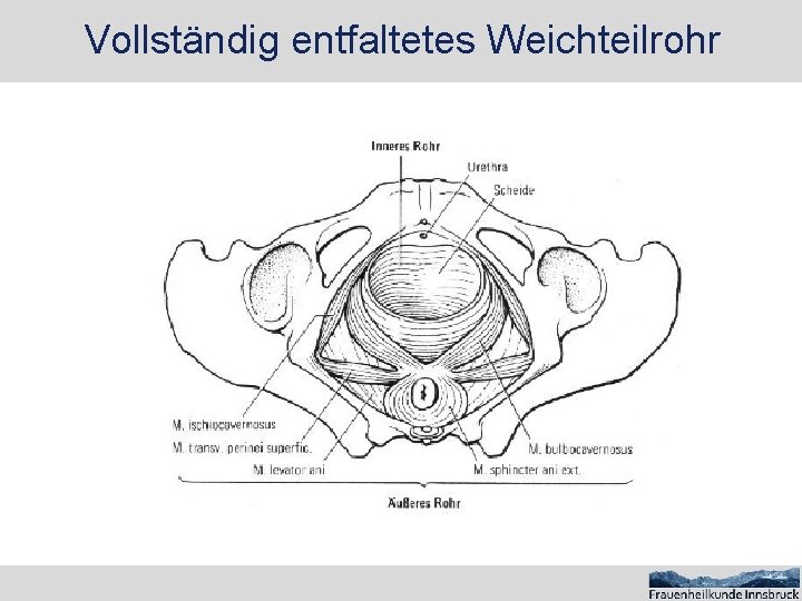 Vollständig entfaltetes Weichteilrohr 