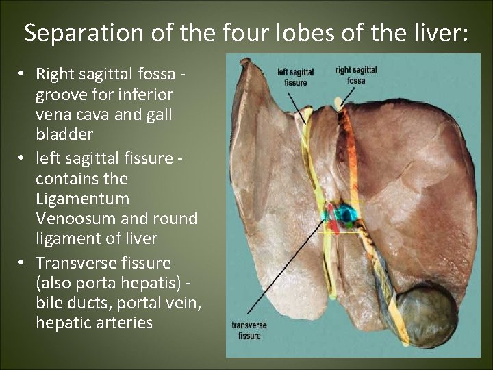 Separation of the four lobes of the liver: • Right sagittal fossa - groove