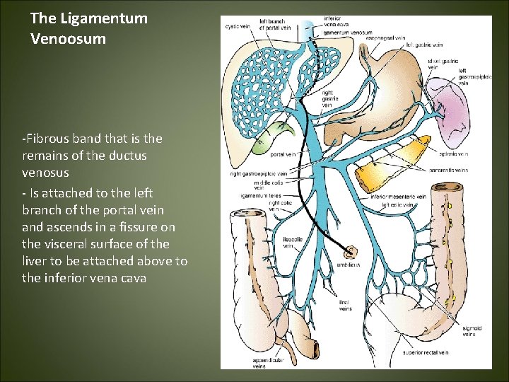 The Ligamentum Venoosum -Fibrous band that is the remains of the ductus venosus -