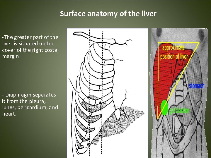 Surface anatomy of the liver -The greater part of the liver is situated under