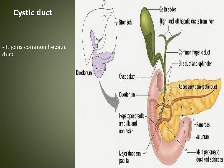 Cystic duct - It joins common hepatic duct 