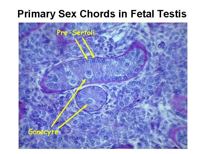 Primary Sex Chords in Fetal Testis Pre-Sertoli Gonocyte 