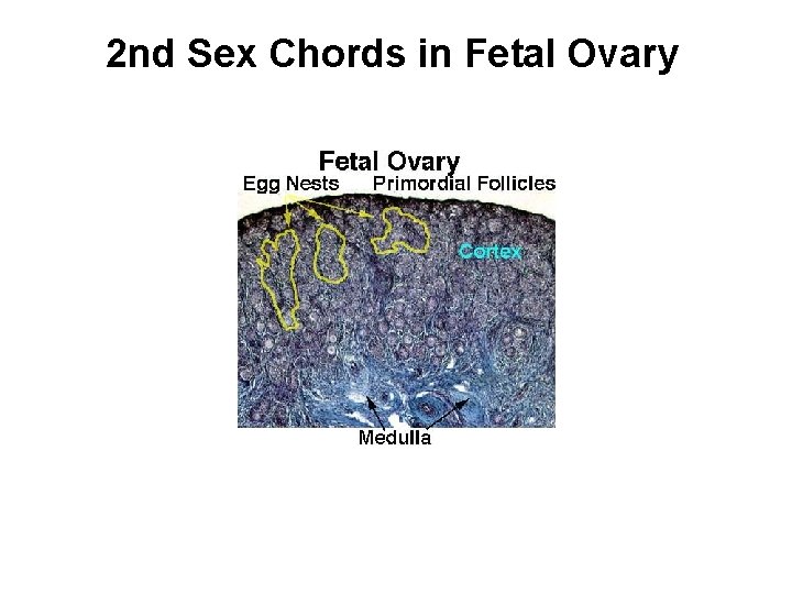 2 nd Sex Chords in Fetal Ovary 