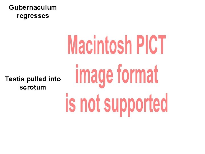 Gubernaculum regresses Testis pulled into scrotum 