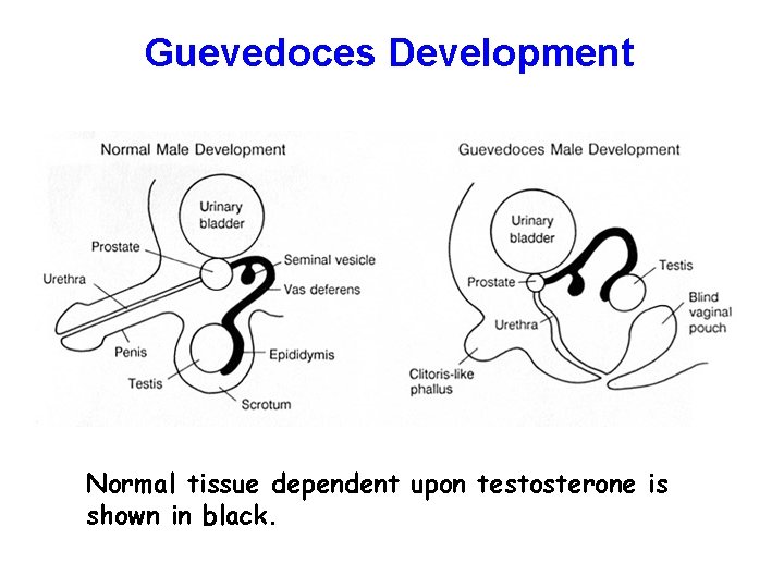Guevedoces Development Normal tissue dependent upon testosterone is shown in black. 