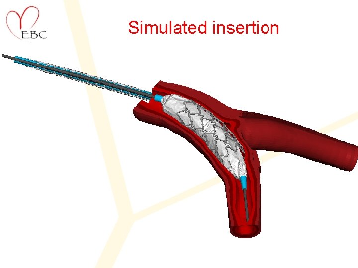 Simulated insertion 