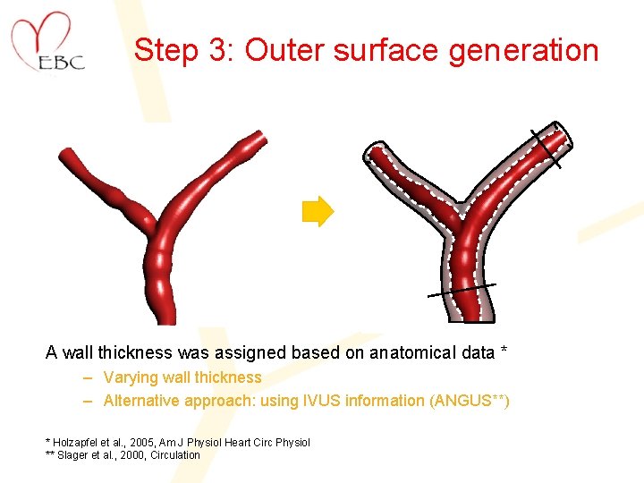 Step 3: Outer surface generation A wall thickness was assigned based on anatomical data