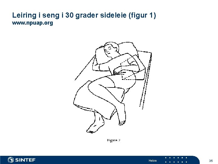Leiring i seng i 30 grader sideleie (figur 1) www. npuap. org Helse 35