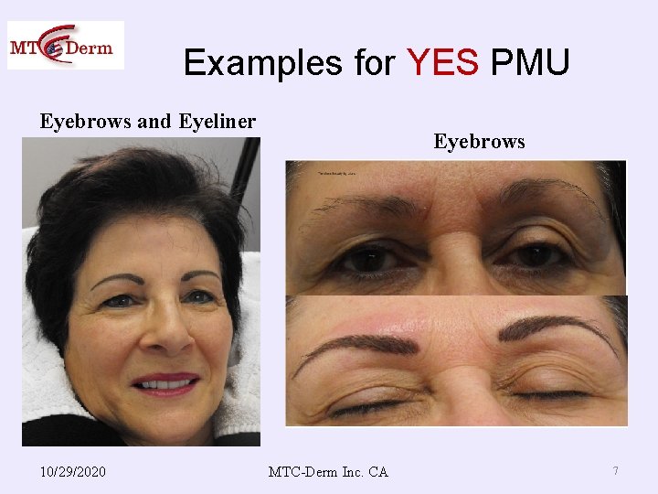 Examples for YES PMU Eyebrows and Eyeliner 10/29/2020 Eyebrows MTC-Derm Inc. CA 7 