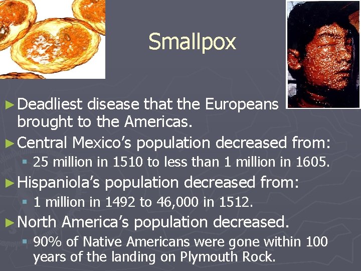 Smallpox ► Deadliest disease that the Europeans brought to the Americas. ► Central Mexico’s