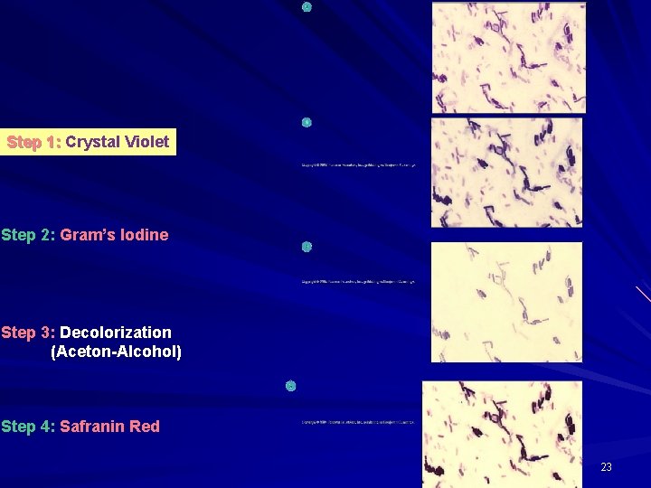 Step 1: Crystal Violet Step 2: Gram’s Iodine Step 3: Decolorization (Aceton-Alcohol) Step 4: