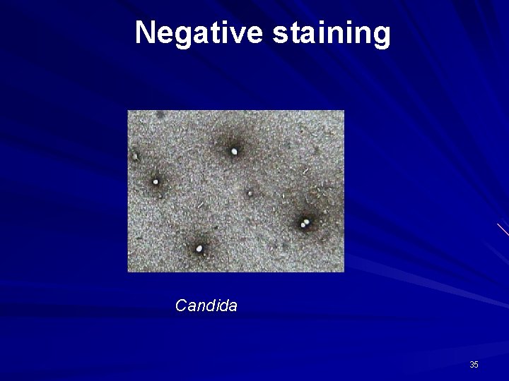 Negative staining Candida 35 