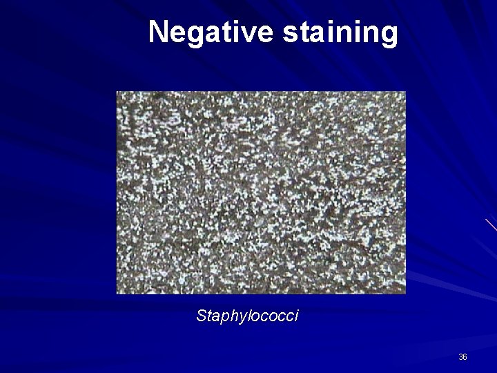 Negative staining Staphylococci 36 