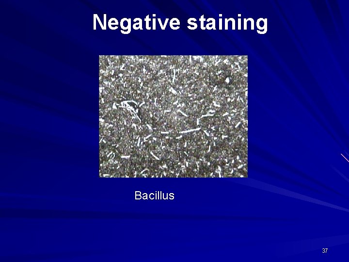 Negative staining Bacillus 37 