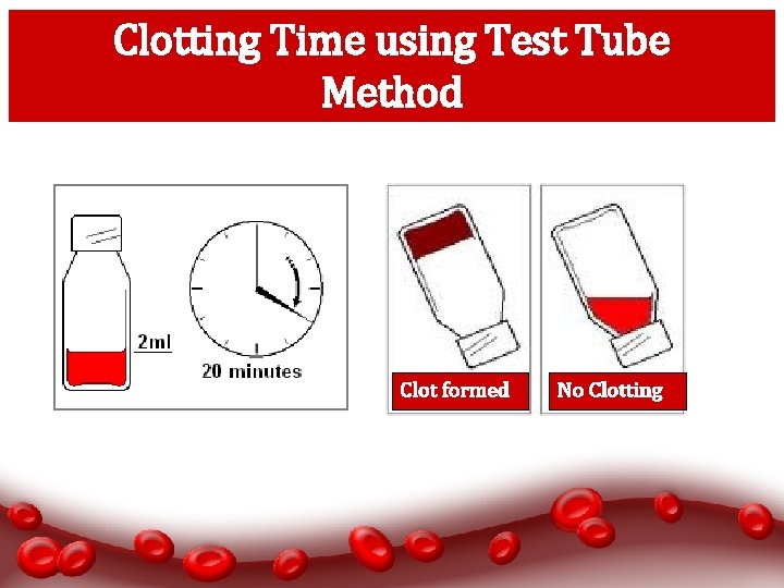 Clotting Time using Test Tube Method Clot formed No Clotting 