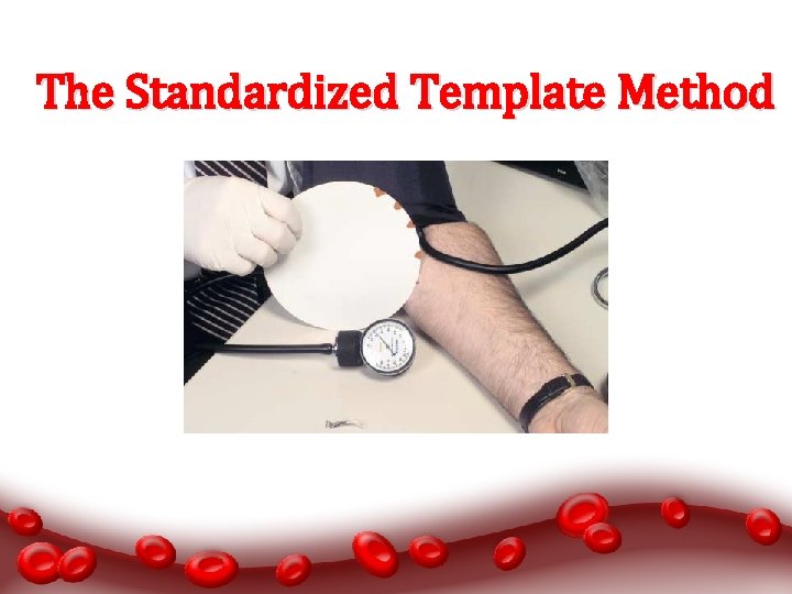 The Standardized Template Method 