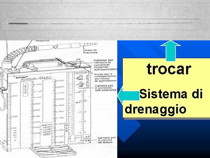 trocar Sistema di drenaggio 