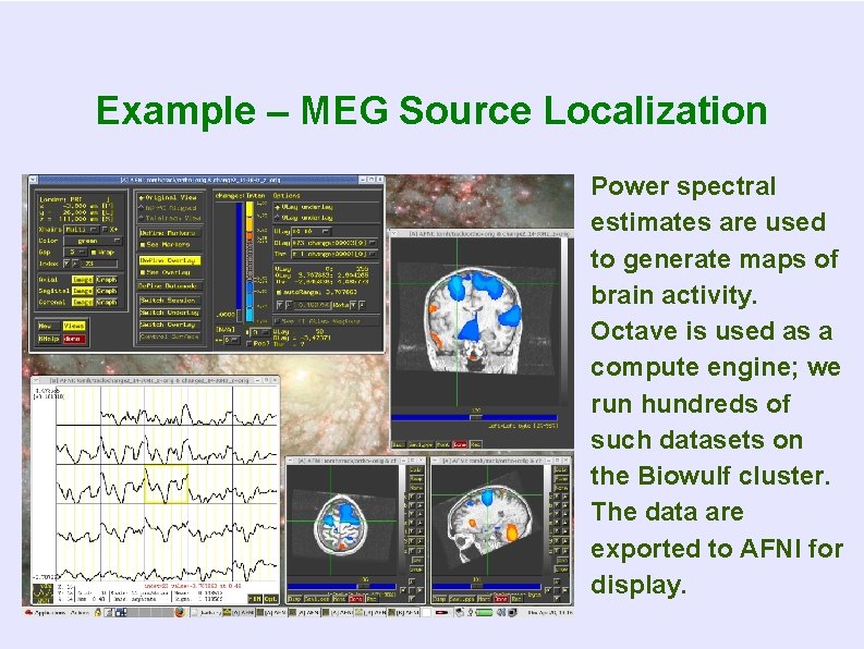 Example – MEG Source Localization Power spectral estimates are used to generate maps of