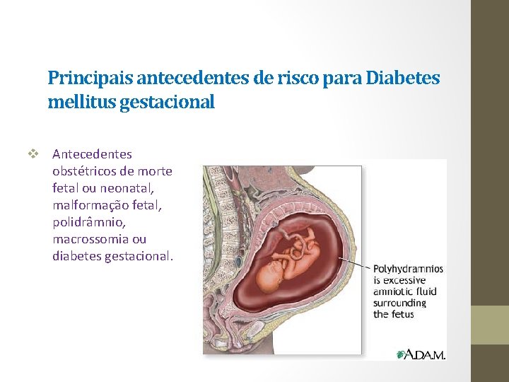 Principais antecedentes de risco para Diabetes mellitus gestacional v Antecedentes obstétricos de morte fetal