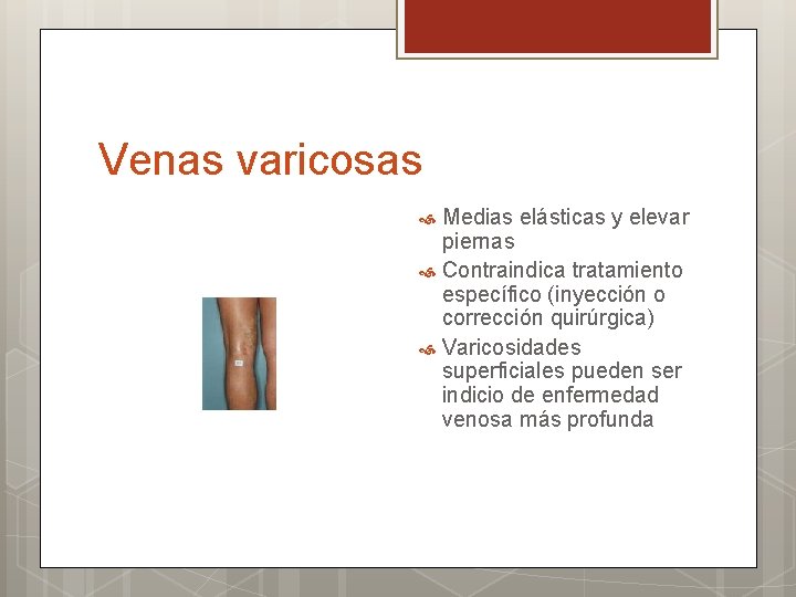 Venas varicosas Medias elásticas y elevar piernas Contraindica tratamiento específico (inyección o corrección quirúrgica)