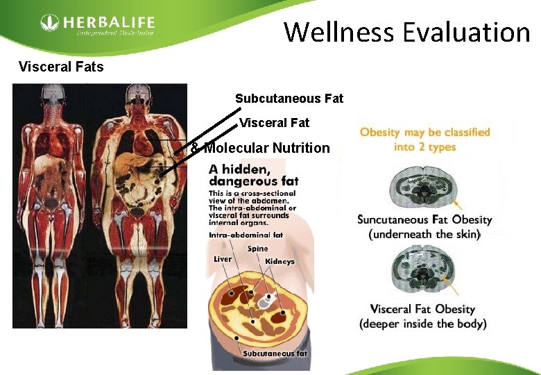 Wellness Evaluation Visceral Fats Subcutaneous Fat Visceral Fat Mark Hughes Cellular & Molecular Nutrition