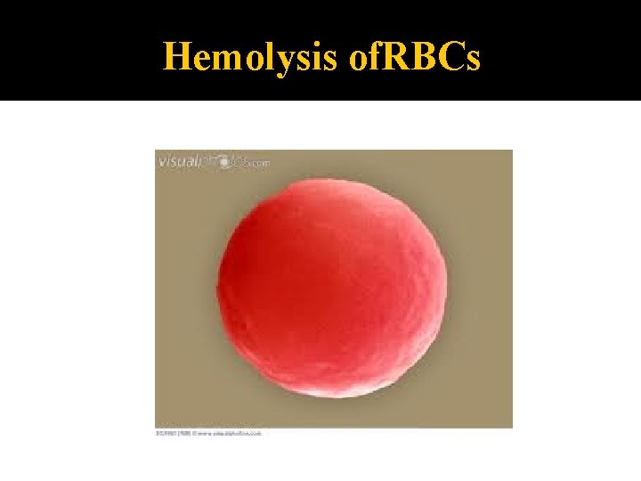 Hemolysis of. RBCs 