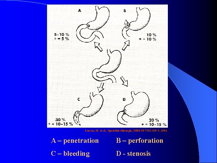 Zeman, M. et al. , Speciální chirurgie, ISBN 80 -7262 -260 -9, 2004 A