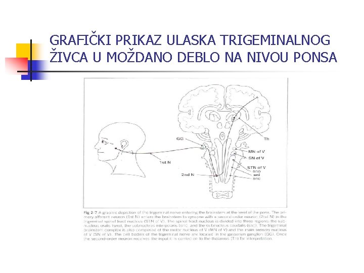 GRAFIČKI PRIKAZ ULASKA TRIGEMINALNOG ŽIVCA U MOŽDANO DEBLO NA NIVOU PONSA 