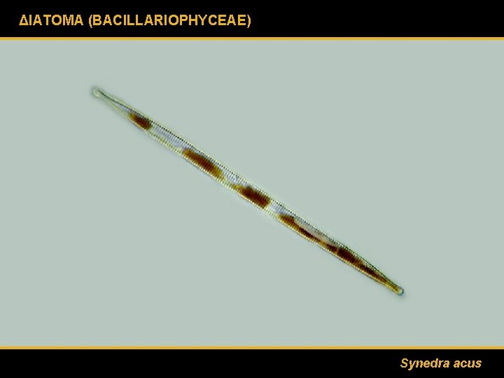 ΔΙΑΤΟΜΑ (BACILLARIOPHYCEAE) Synedra acus 