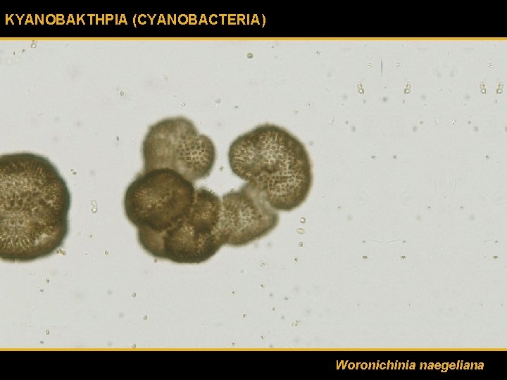 ΚΥΑΝΟΒΑΚΤΗΡΙΑ (CYANOBACTERIA) Woronichinia naegeliana 