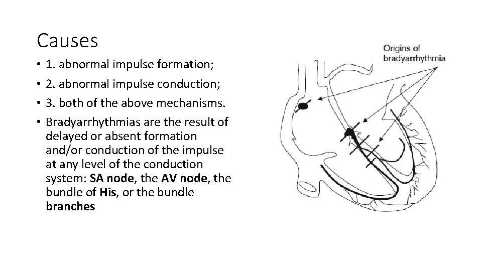 Causes • • 1. abnormal impulse formation; 2. abnormal impulse conduction; 3. both of