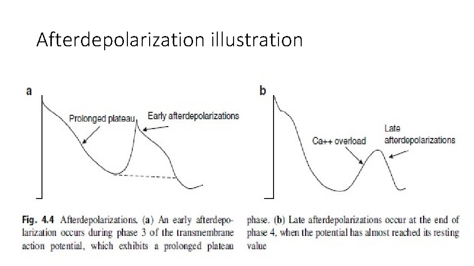 Afterdepolarization illustration 