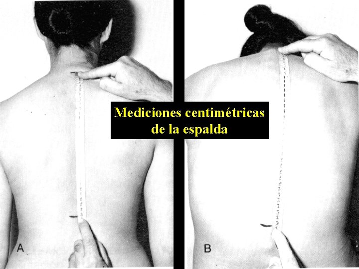 Mediciones centimétricas de la espalda 