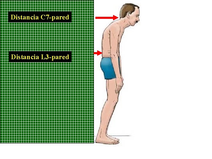 Distancia C 7 -pared Distancia L 3 -pared 
