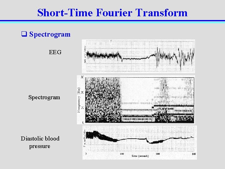 Short-Time Fourier Transform q Spectrogram EEG Spectrogram Diastolic blood pressure 