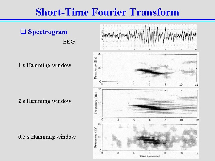 Short-Time Fourier Transform q Spectrogram EEG 1 s Hamming window 2 s Hamming window