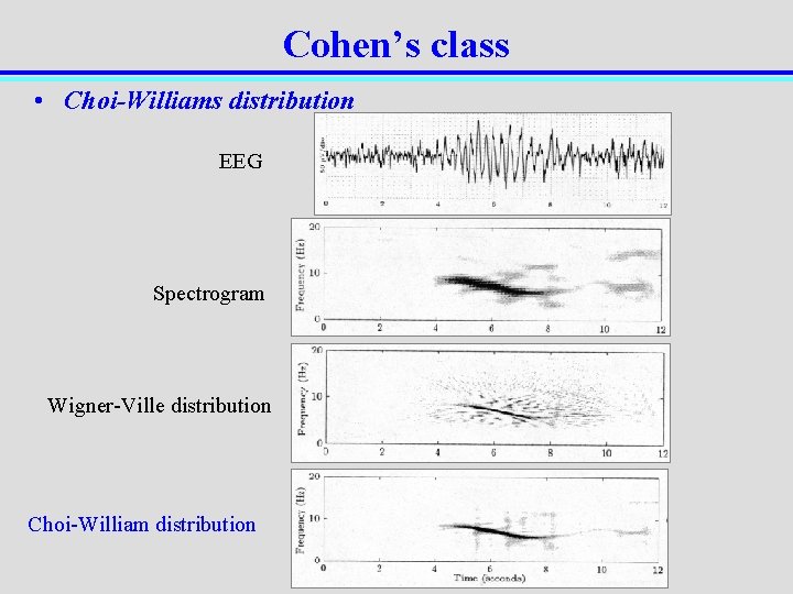 Cohen’s class • Choi-Williams distribution EEG Spectrogram Wigner-Ville distribution Choi-William distribution 