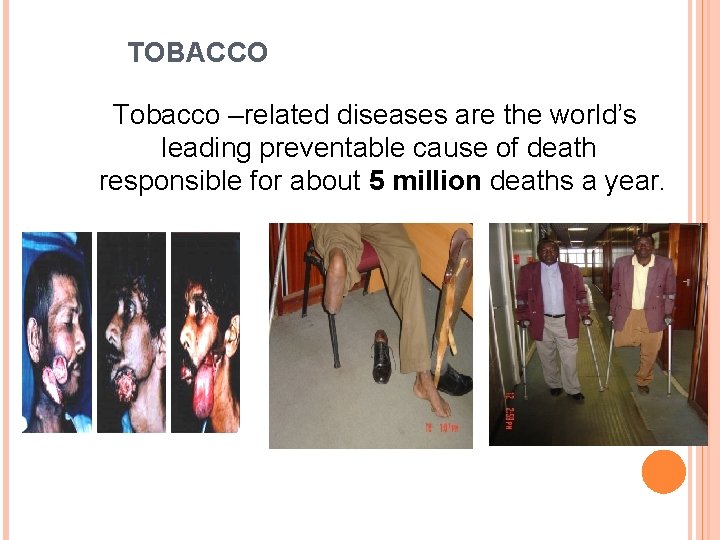  TOBACCO Tobacco –related diseases are the world’s leading preventable cause of death responsible