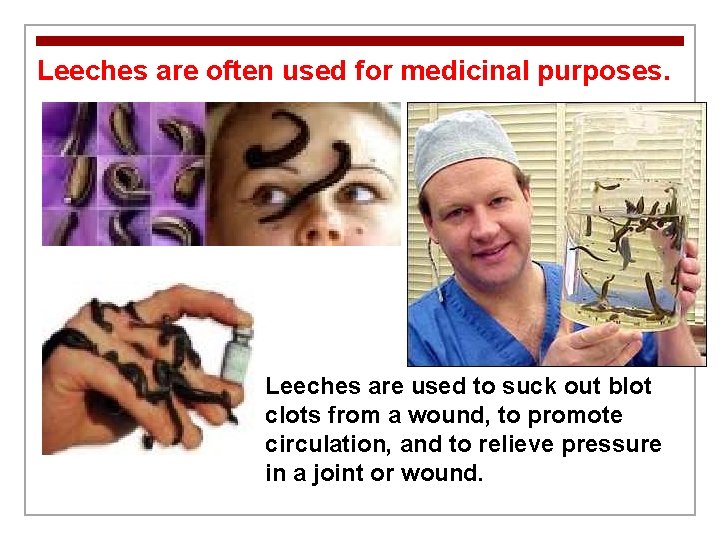 Leeches are often used for medicinal purposes. Leeches are used to suck out blot