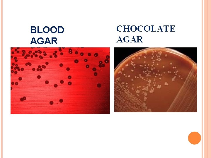 BLOOD AGAR CHOCOLATE AGAR 