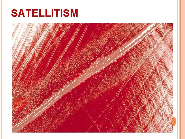 SATELLITISM 