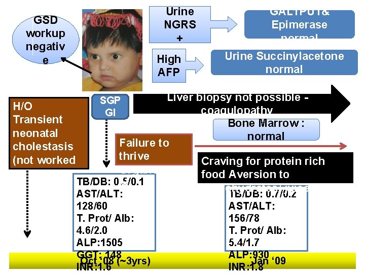 Urine NGRS + GSD workup negativ e High AFP GAL 1 PUT& Epimerase normal