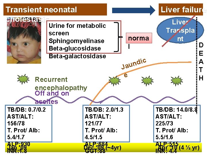 Transient neonatal cholestasis Liver failure! Urine for metabolic screen Sphingomyelinase Beta-glucosidase Beta-galactosidase Recurrent encephalopathy