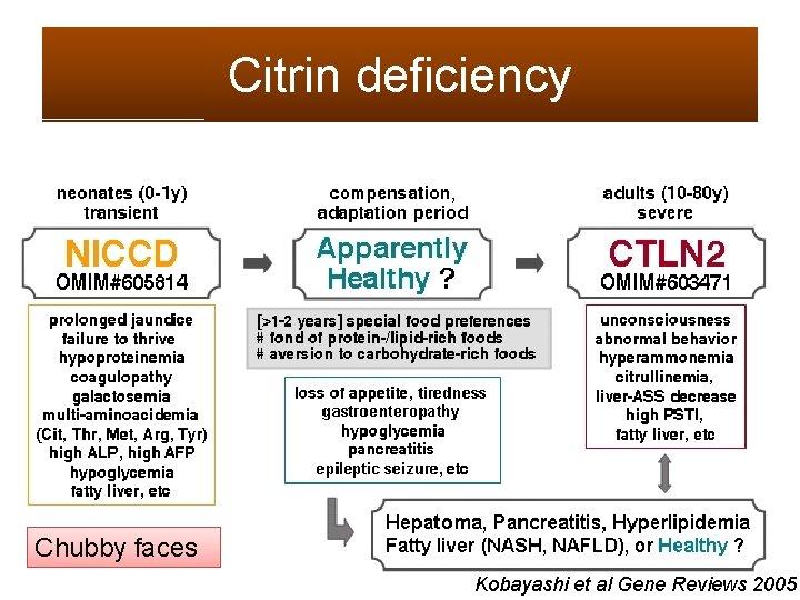 Citrin deficiency Chubby faces Kobayashi et al Gene Reviews 2005 