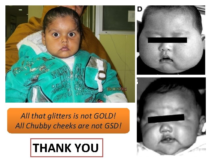 All that glitters is not GOLD! All Chubby cheeks are not GSD! THANK YOU