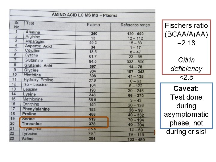 Fischers ratio (BCAA/Ar. AA) =2. 18 Citrin deficiency <2. 5 Caveat: Test done during