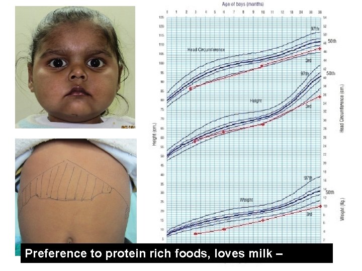 Preference to protein rich foods, loves milk – 